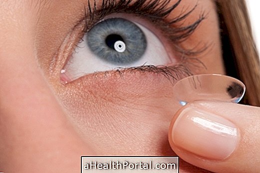 7 Things You Can not Do If You Have Conjunctivitis