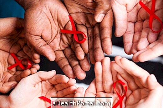 What is AIDS and HIV, history, how to get it, treatment and cure