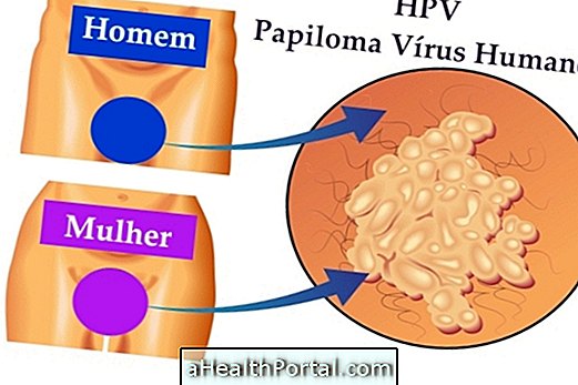 การรักษาด้วย HPV - การเยียวยาและการผ่าตัด