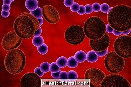 Was ist eine Blutinfektion und wie ist sie zu behandeln?