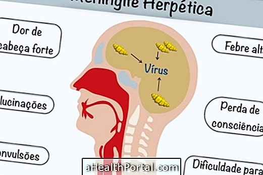 Wie man herpetische virale Meningitis identifiziert und behandelt