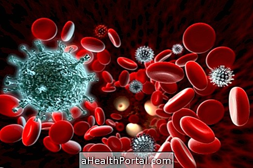 What is HTLV infection and major symptoms