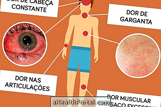 Comment savoir si vous êtes avec Zika - Symptômes et tests