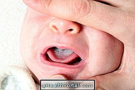Hvordan man identificerer og helbreder Baby Thrush