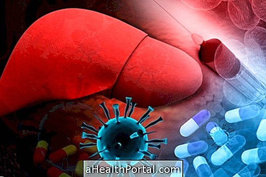 Što je akutni hepatitis i kada to može biti ozbiljno?