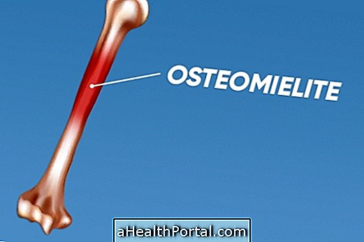 What is osteomyelitis and how to identify