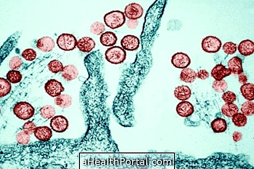 Що таке хантавірус і як він виглядає