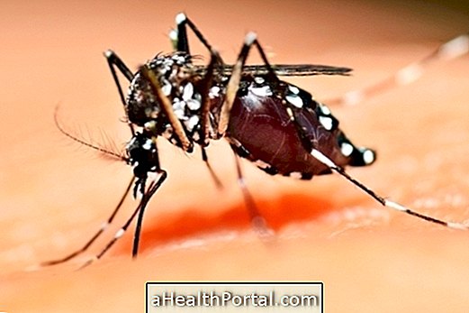 Lær hvordan man behandler dengue for at forhindre komplikationer