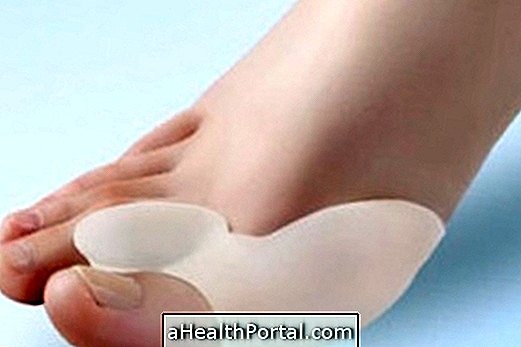 Exercises for bunion and how to care for feet