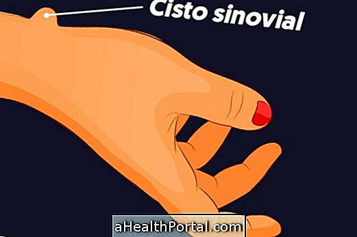 chist sinovial | Forumul Medical ROmedic
