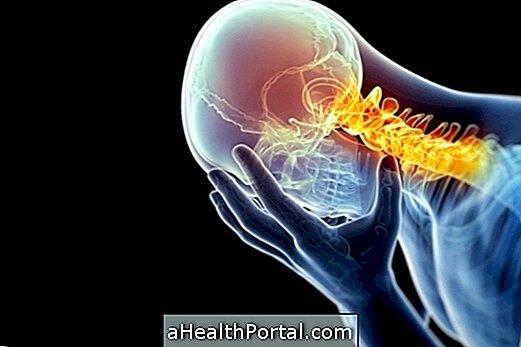 Čo je cervikálna spondylartróza a ako ju liečiť