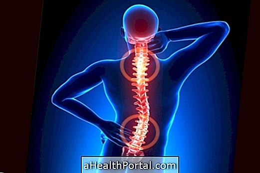 כיצד לזהות ולטפל arthrosis בעמוד השדרה