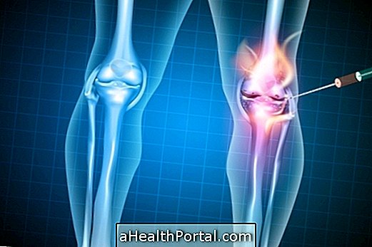 घुटने घुसपैठ दर्द से लड़ता है और गठिया में सुधार करता है