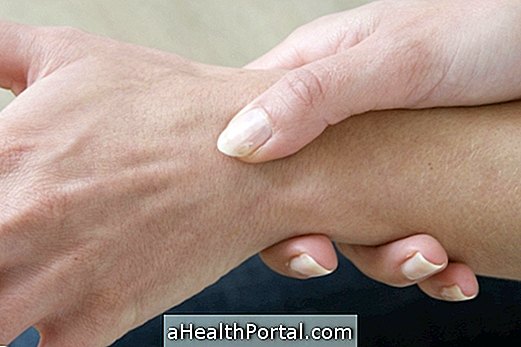 What is Tenosynovitis and How to Treat