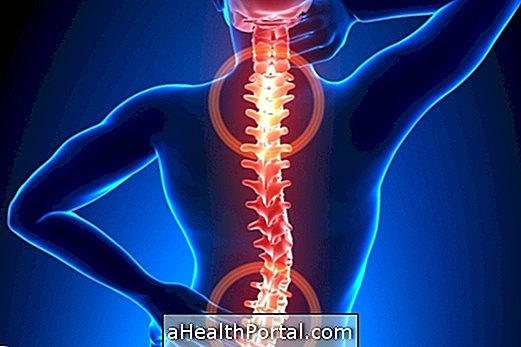 Treatment for Herniated Disc with Physiotherapy