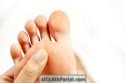 What is and How to Identify Morton's Neuroma