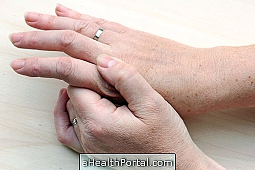 Arthritis a kezében: tünetek, okok és kezelés