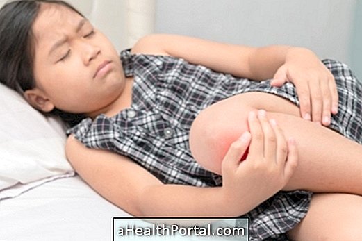 דלקת פרקים בילדות: גורם, תסמינים וטיפול