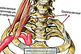 Príznaky krčnej chrbtice