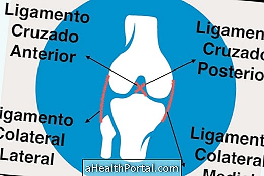 How to treat a knee ligament injury