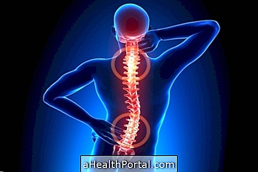 Behandling af artros i rygsøjlen