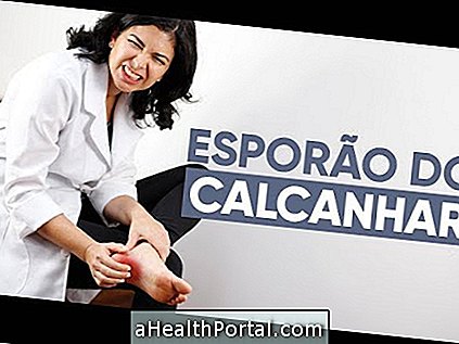 Perawatan untuk Esporão do Calcâneo