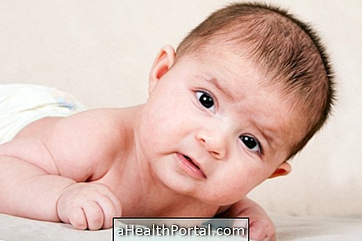 Cara mengubati torticollis kongenital pada bayi