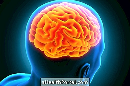 What is arachnoid cyst and what are the symptoms