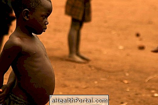 Qu'est-ce que la malnutrition Kwashiorkor?