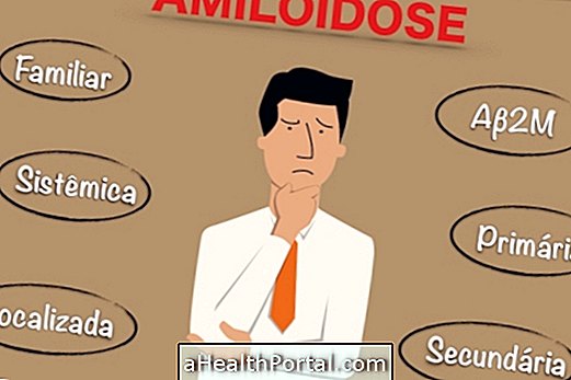 Hvordan man identificerer amyloidose
