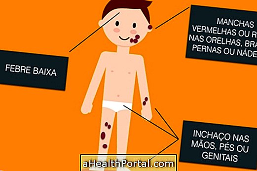 Hvordan man identificerer og behandler børns urticaria vaskulitis