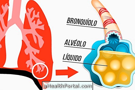 What can cause water in the lung and how to treat it