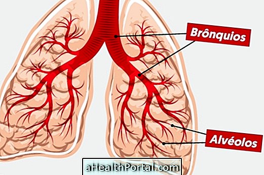 Vad är bronkopneumoni och hur man behandlar det