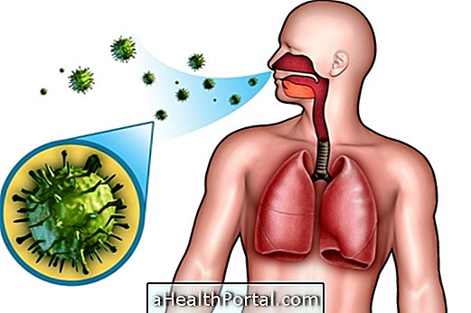 maladies respiratoires - Pneumonie communautaire: Qu'est-ce que c'est, Symptômes et traitement