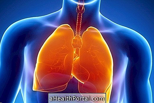 Pneumonitis: hvad det er, typer, symptomer og hvordan behandlingen er færdig