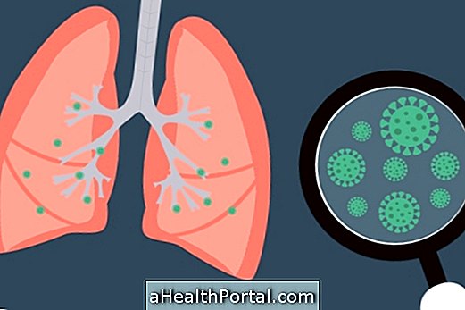 Bakterielle Pneumonie - Identifizieren und Übertragen