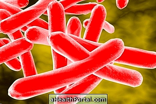 Ist Tuberkulose-Heilung?