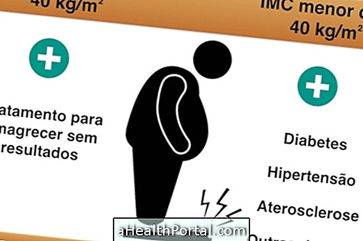 When bariatric surgery is indicated to treat obesity