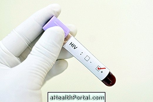 A HIV-teszt eredményének megértése