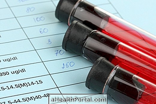 examens de diagnostic - Que signifie le résultat du test à l'urée?