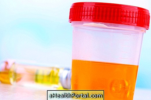 What it is and what the causes of proteinuria