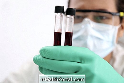 What is arterial blood gas
