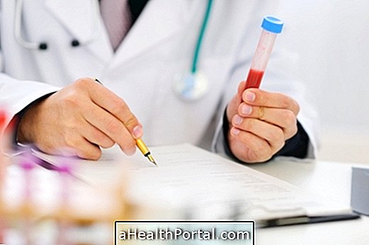 What is high or low creatinine?