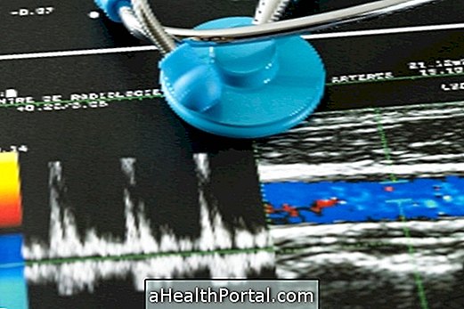 What is Color Doppler Ultrasound and what is it for?