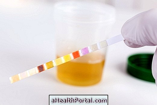 Hvad er urinscreening og hvordan man gør det