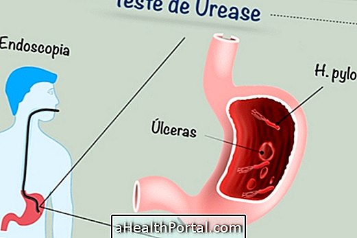 How is the Urease Test detecting H. pylori