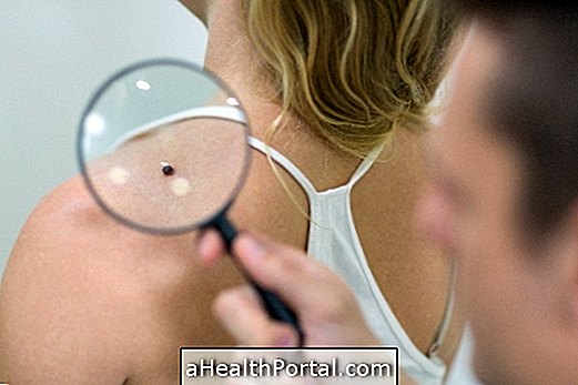 Kako je opravljen dermatološki pregled?