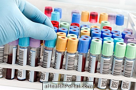 Blood phosphorus test: hvordan det er gjort og referenceværdier