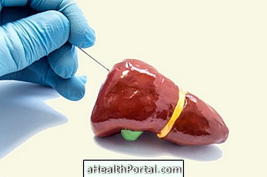 Što je biopsija jetre?