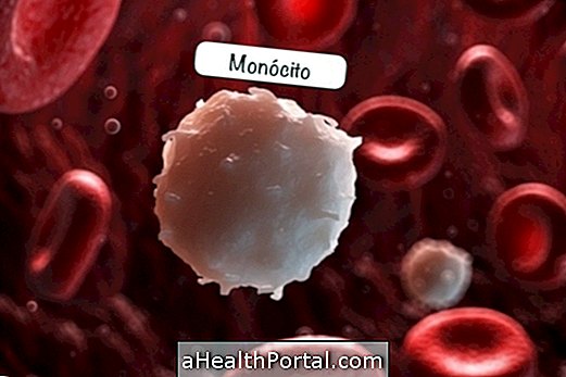 Monocytes - What They Are and Reference Values